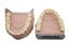 Monomaterial Teeth with Cavities (Biovoxel Typodont) - Zahn wählen: 37 Occlusal Cavity