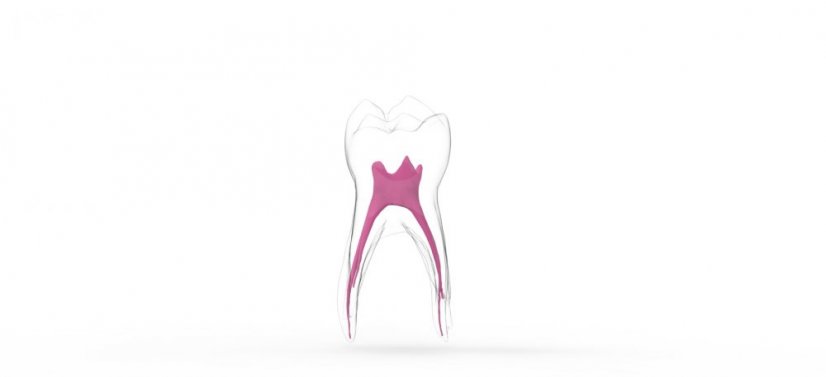 EndoTooth 84 Deciduous Lower Molar - Transparencia: Opaco, Acceso al diente: Intacto, no accedido, Pulpa dentaria: Con tejido pulpar
