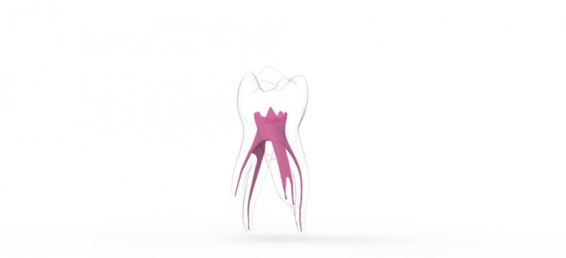 EndoTooth 84 Deciduous Lower Molar - Transparency: Transparent, Tooth Access: Intact, Non-Accessed, Pulp: With pulpal tissue