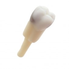 CariesTooth 46 Pre Endo (KaVo Analog)