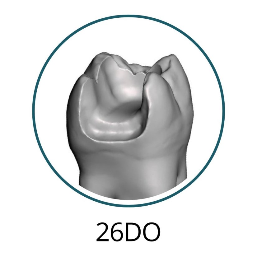 Monomaterial Teeth with Cavities (Biovoxel Typodont) - Zahn wählen: 37 Occlusal Cavity