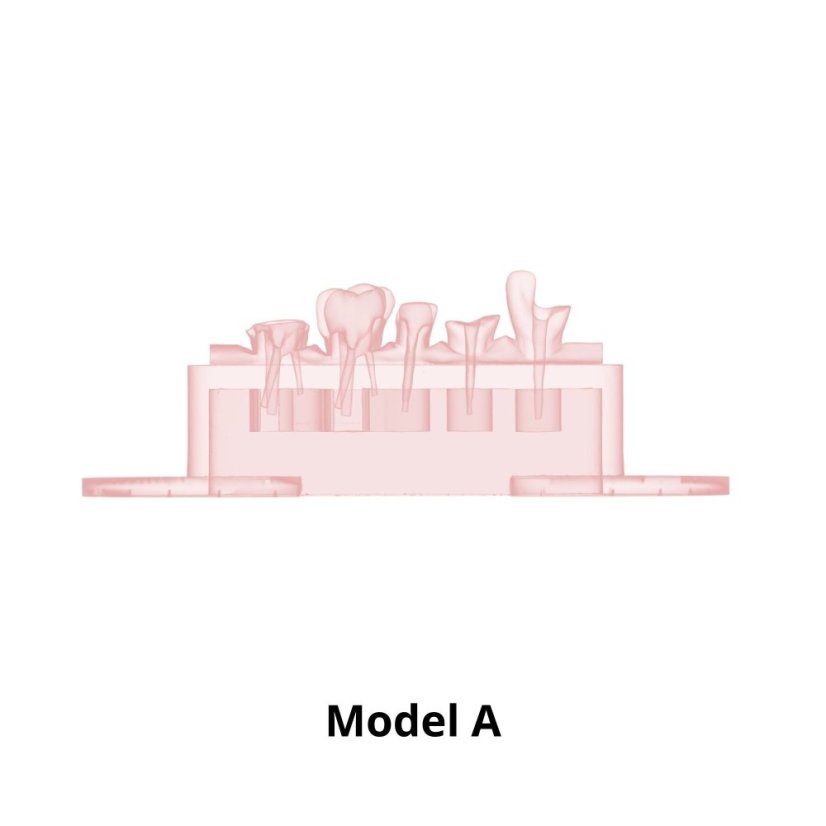Post-Endo Model - Modelo: Modelo B