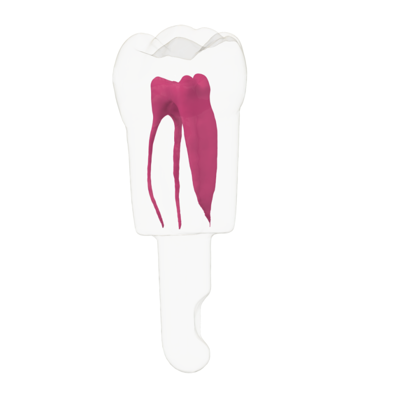EndoTooth 36 Lower Molar (KaVo Analog)