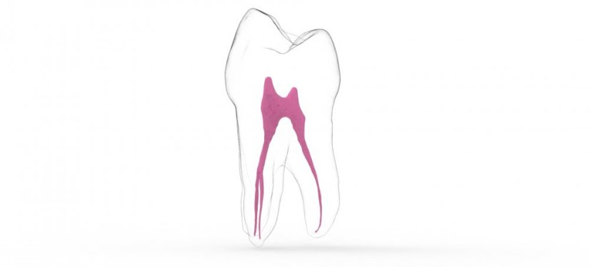 EndoTooth 14 Upper Premolar