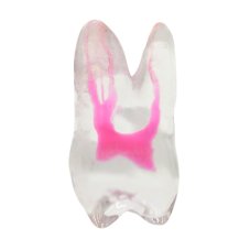 Endotooth 16 Upper Molar (Biovoxel Typodont)
