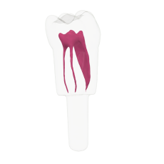 EndoTooth 36 Lower Molar (KaVo Analog)