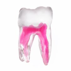 EndoTooth 37 Lower Molar (More Complex)