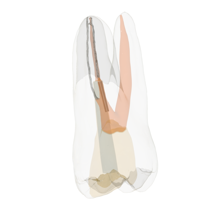 Re-Endotooth 26 (Biovoxel Typodont) - Transparency: Transparent
