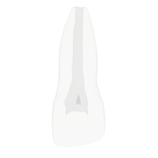 EndoTooth 11 Incomplete Root Formation