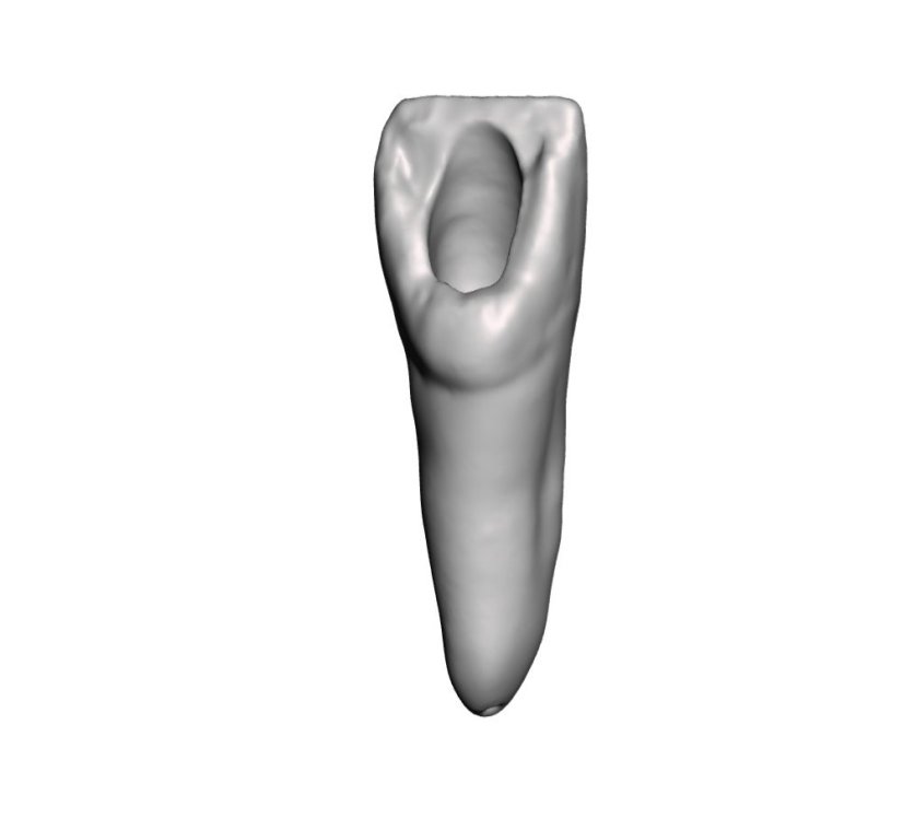 EndoTooth 11 Upper Incisor für internes Bleichtraining (Biovoxel Typodont)