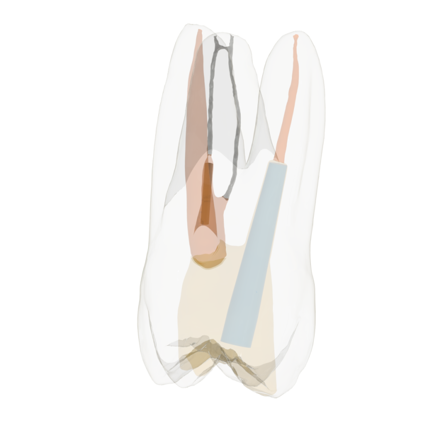 Re-Endotooth 26 (Biovoxel Typodont) - Transparency: Opaque