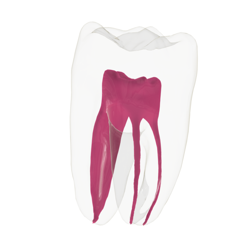 EndoTooth 36 Lower Molar (Less Complex) - Transparencia: Transparente, Acceso al diente: Intacto, no accedido