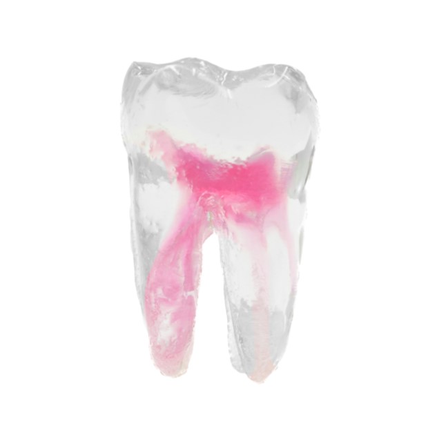 EndoTooth 36 Lower Molar (Less Complex) - Transparencia: Transparente, Acceso al diente: Intacto, no accedido