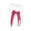 EndoTooth 37 Lower Molar (More Complex)