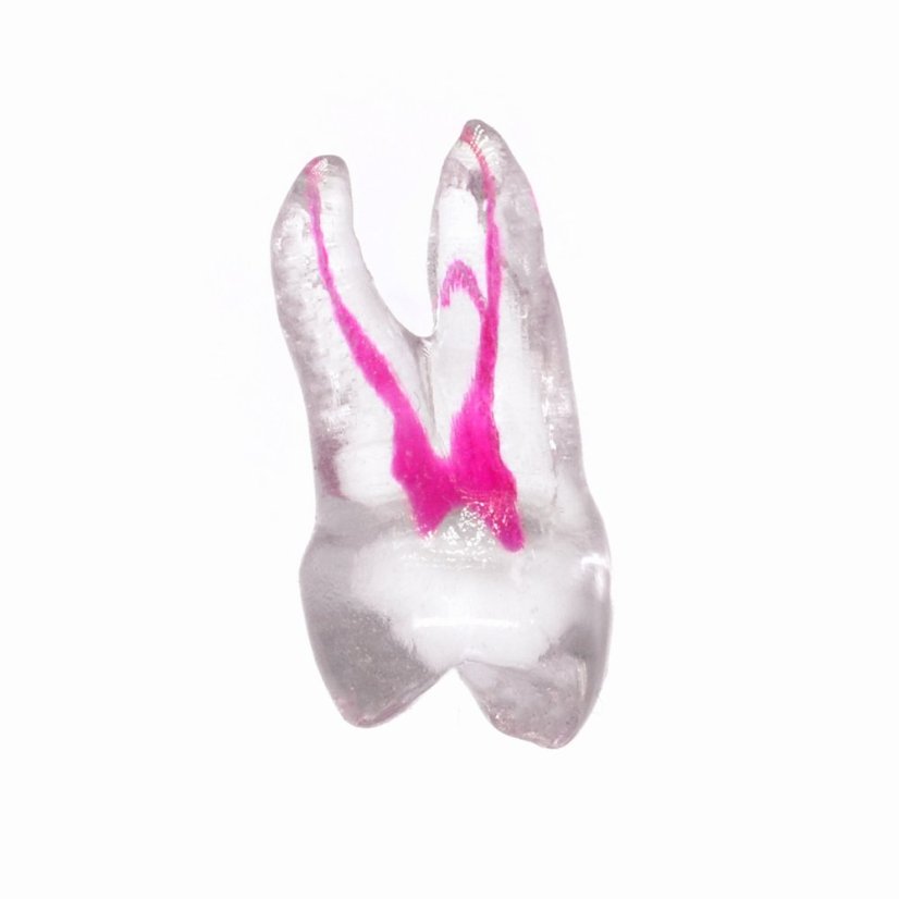 EndoTooth 14 Upper Premolar - Transparencia: Opaco, Acceso al diente: Intacto, no accedido, Pulpa dental: Con pulpa