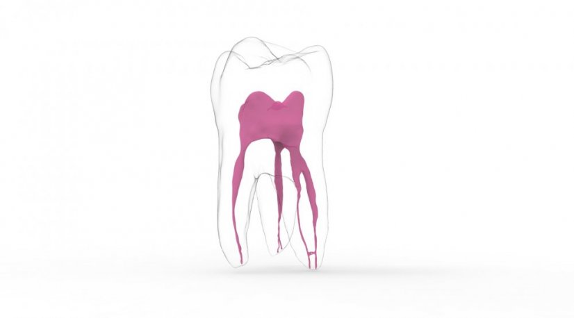 EndoTooth 16 Upper Molar (More Complex) - Transparency: Transparent, Tooth Access: Intact, Non-Accessed, Pulp: With pulpal tissue