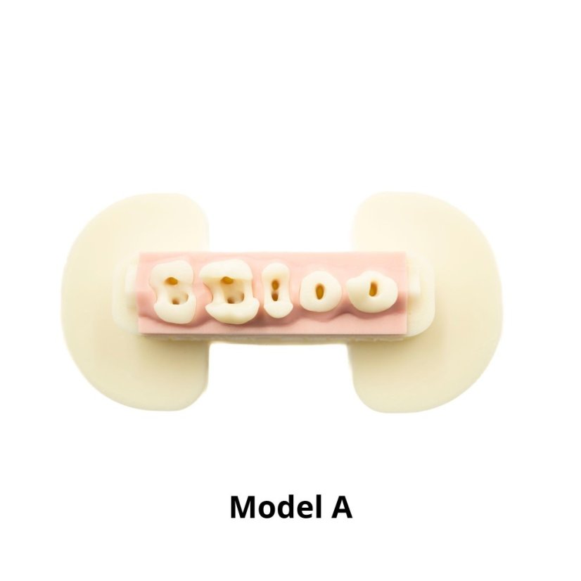 Post-Endo Model