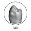 Monomaterial Teeth with Cavities (Biovoxel Typodont) - Zahn wählen: 37 Occlusal Cavity