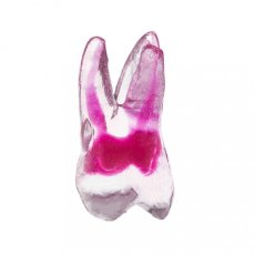 EndoTooth 16 Upper Molar (More Complex)