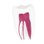 EndoTooth 36 Lower Molar (Less Complex) - Transparencia: Transparente, Acceso al diente: Intacto, no accedido