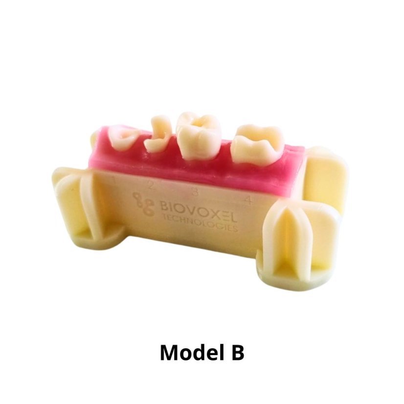 Post-Endo Model