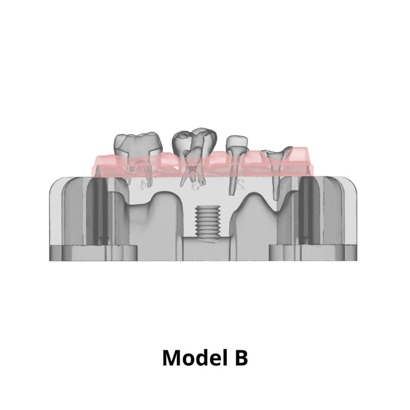 Post-Endo Model