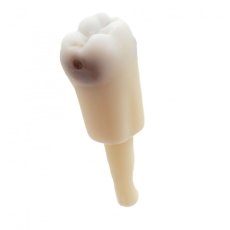 CariesTooth 46 Pre Endo (KaVo Analog)