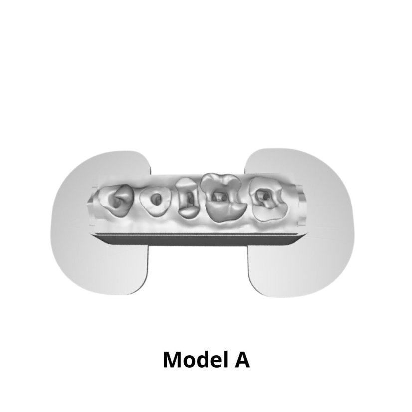 Post-Endo Model - Modelo: Modelo B