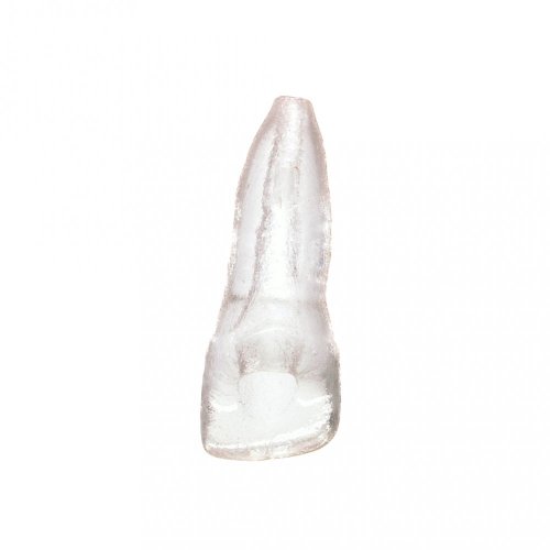 EndoTooth 11 Incomplete Root Formation - Pulpa dentaria: Sin tejido pulpar