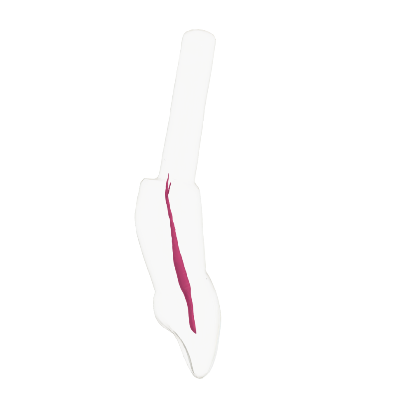 EndoTooth 11 Central Incisor (KaVo Analog)