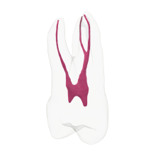 EndoTooth 14 Upper Premolar