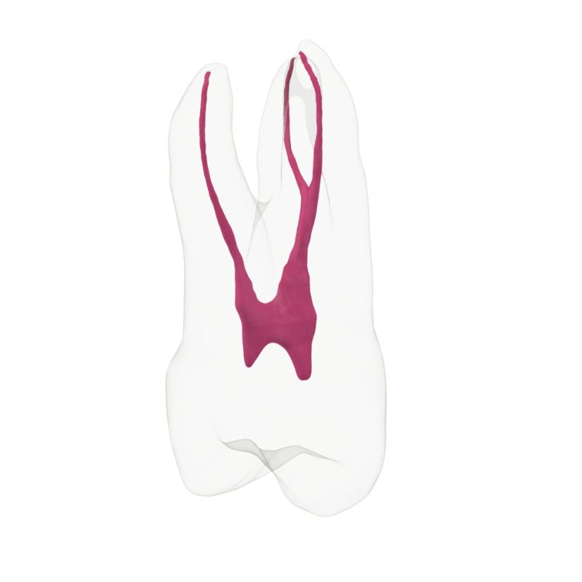 EndoTooth 14 Upper Premolar - Priehladnosť: Priehľadný, Trepanácia: Trepanovaný, Zubná dreň: Bez drene