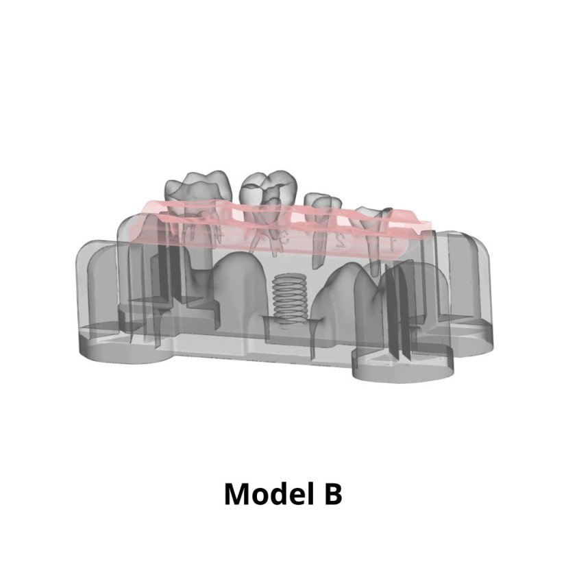 Post-Endo Model