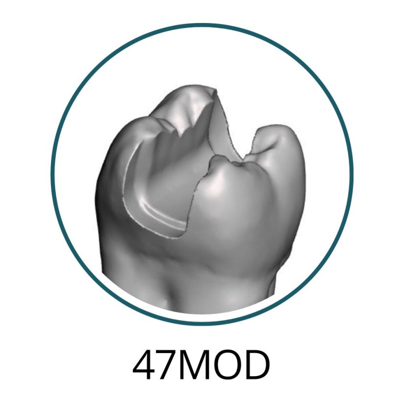 Monomaterial Teeth with Cavities (Biovoxel Typodont) - Elige el diente: 15 Mesio - Occluso - Distal Cavity