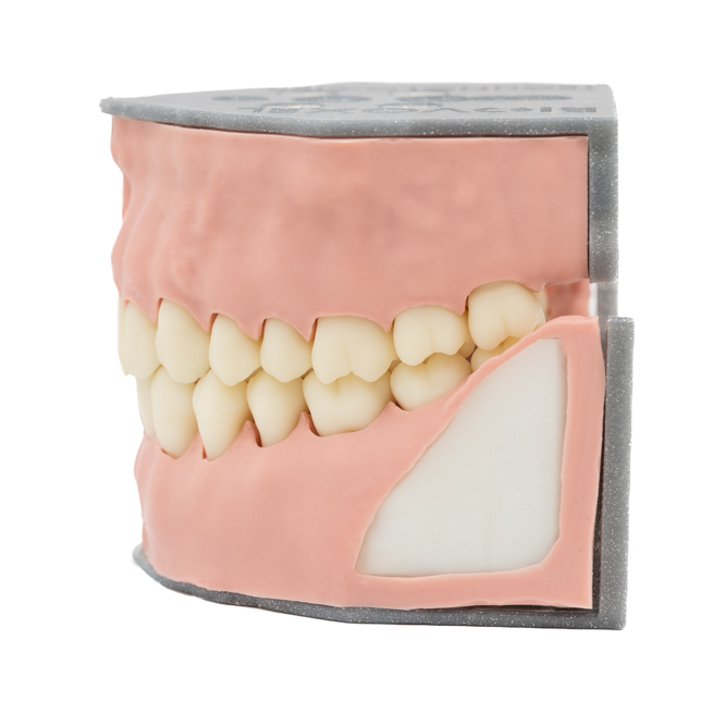 Biovoxel Typodont Jaw - Kiefer: Ober- und Unterkiefer, Typodont Type: Periodontal