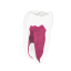 EndoTooth 37 Lower Molar (More Complex)