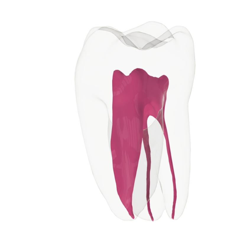 EndoTooth 36 Lower Molar (Less Complex) - Transparencia: Transparente, Acceso al diente: Intacto, no accedido