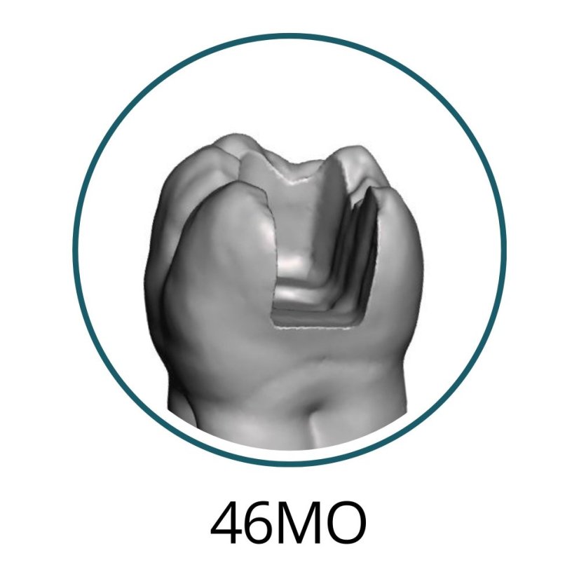 Monomaterial Teeth with Cavities (Biovoxel Typodont) - Elige el diente: 15 Mesio - Occluso - Distal Cavity