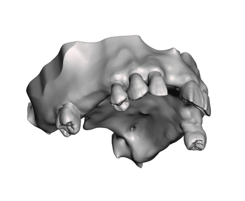 Surgical Training Jaw Model