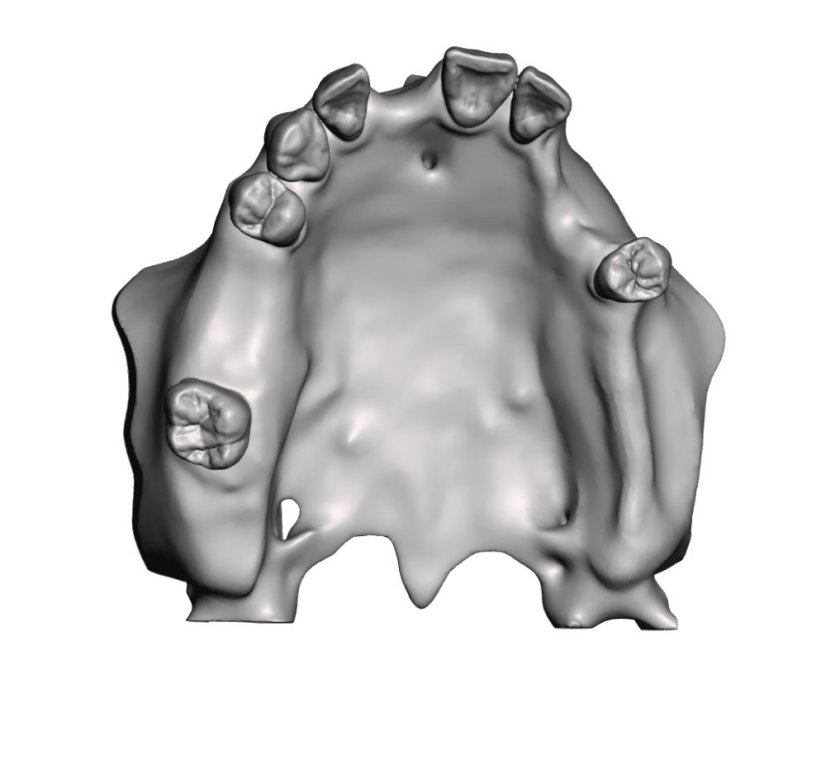 Surgical Training Jaw Model