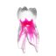 EndoTooth 84 Deciduous Lower Molar - Transparencia: Opaco, Acceso al diente: Accedido, Pulpa dental: Con pulpa