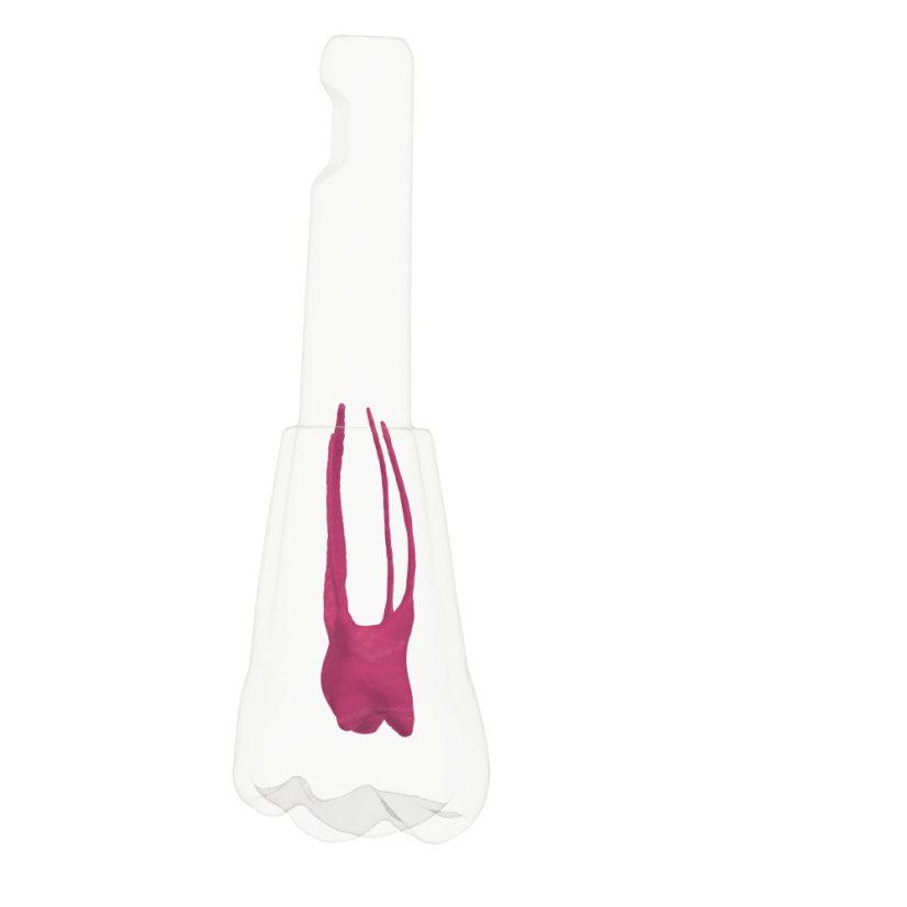 EndoTooth 16 Upper Molar - Less Complex (KaVo Analog)