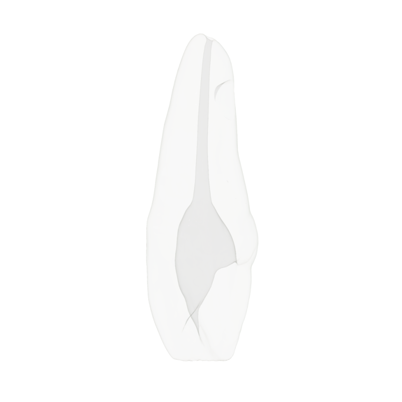 EndoTooth 11 Upper Incisor for Internal Bleach Training (Biovoxel Typodont)