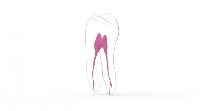 EndoTooth 24 Upper Premolar - Tooth Access: Intact, Non-Accessed, Pulp: With pulpal tissue