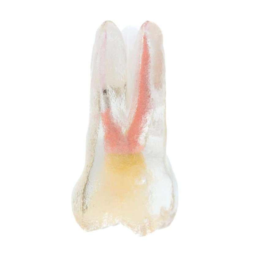 Re-Endotooth 26 (Biovoxel Typodont) - Transparency: Transparent
