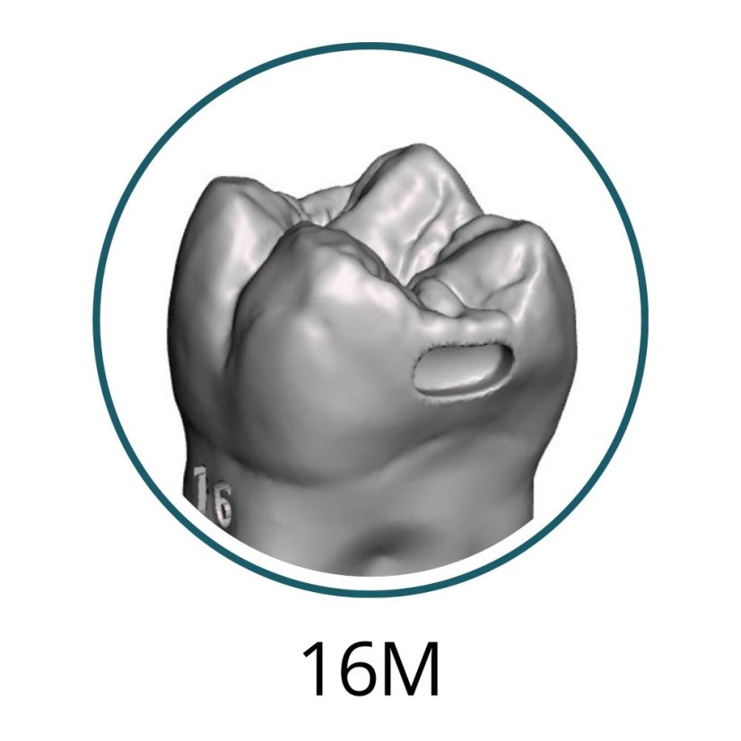 Monomaterial Teeth with Cavities (Biovoxel Typodont) - Elige el diente: 15 Mesio - Occluso - Distal Cavity
