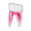 EndoTooth 37 Lower Molar (More Complex)
