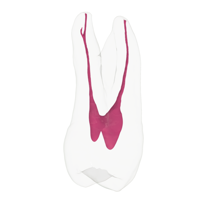 EndoTooth 24 Upper Premolar