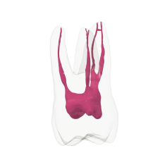 EndoTooth 16 Upper Molar (More Complex)