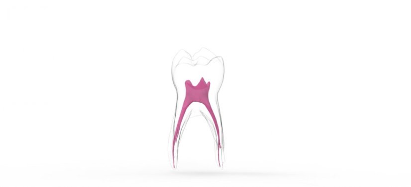 EndoTooth 84 Deciduous Lower Molar - Transparencia: Transparente, Acceso al diente: Intacto, no accedido, Pulpa dentaria: Con tejido pulpar